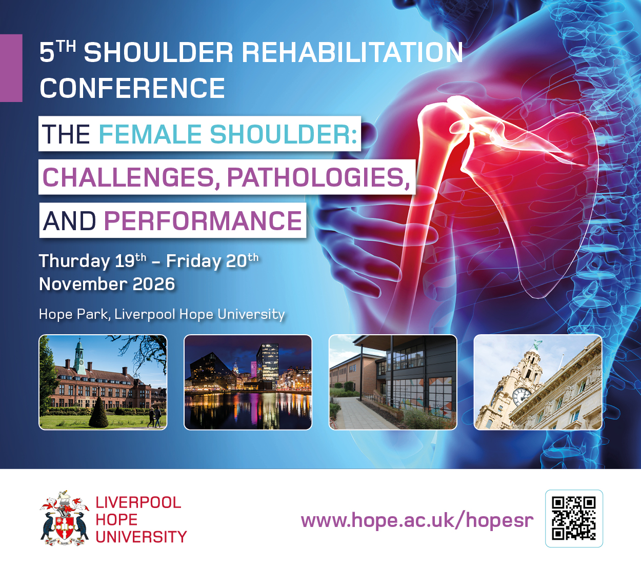 The Female Shoulder: Challenges, Pathologies and Performance
