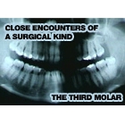 Close encounters of a surgical kind