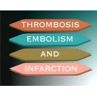 Thrombosis, Embolism and Infarction