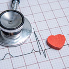 ECG