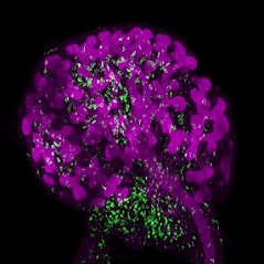 Nephrogenesis