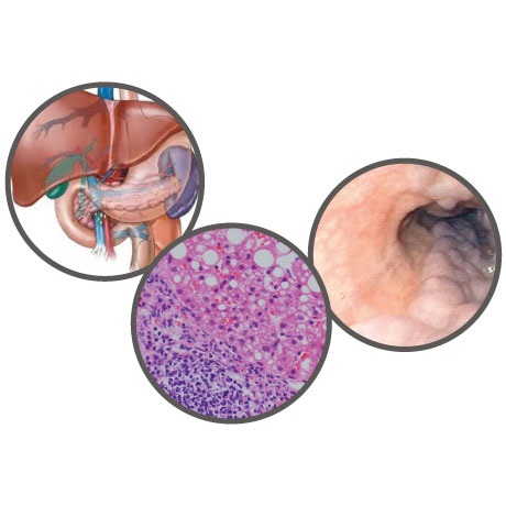UCL Sheila Sherlock Postgrad Hepatology Course