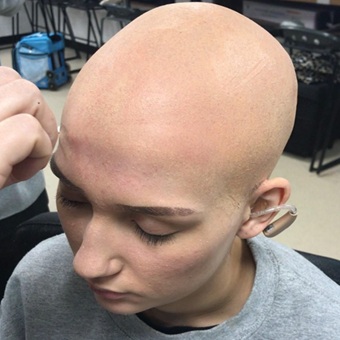 Bald Cap
