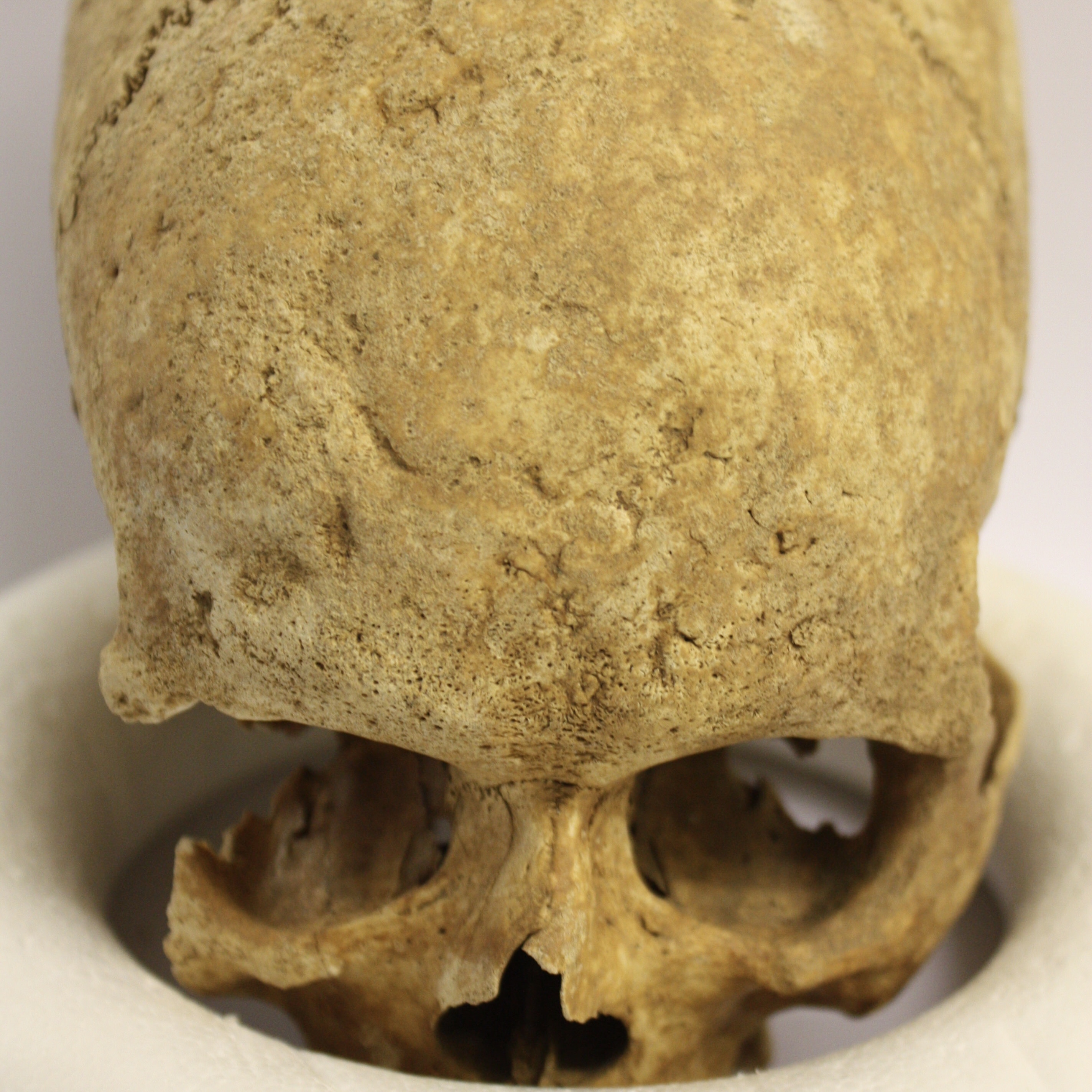 Decaying human skull